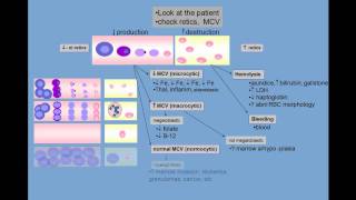 Anemia differential diagnosis [upl. by Granese272]