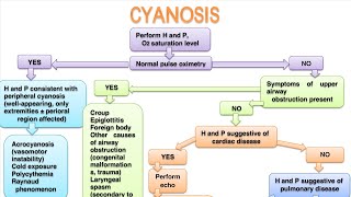 CYANOSIS In pediatrics [upl. by Oilisab79]