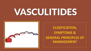 Vasculitides  Classification Clinical Features and Management Principles [upl. by Kaitlynn]