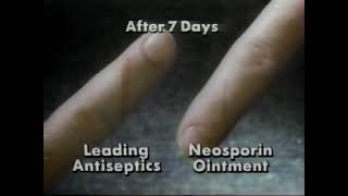 Neosporin Commercial 1991 [upl. by Leddy]