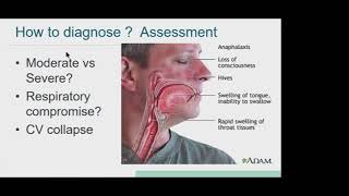 05 Contrast Induced Anaphylactoid Reaction [upl. by Nerehs]