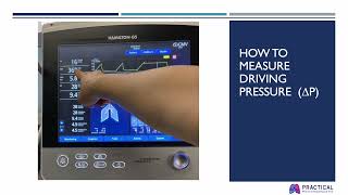 Measuring Respiratory System Elastance during Controlled Mechanical Ventilation Why and How [upl. by Glassman]