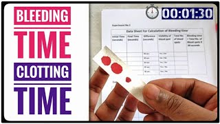 BT CT Test  Bleeding Time AND Clotting Time Coagulation Time Blood Test [upl. by Dabney510]