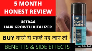 जानिए पूरा सच  Ustraa Hair Growth Vitalizer 100 Real 5 Month use review  BIG FIT [upl. by Malloy288]