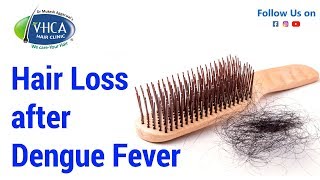 Hair Loss after Dengue Fever 2018 डेंगू बुखार के बाद बालों का झड़ना । Dr Mukesh Aggarwal VHC [upl. by Xineohp]