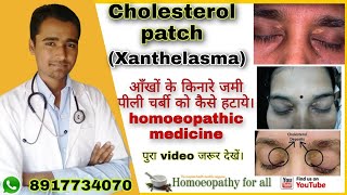 xanthelasma cholesterol patch homoeopathic medicine dr arun upadhyay [upl. by Dian]