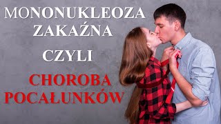 Mononukleoza Zakaźna czyli Choroba Pocałunków Co to jest Jak się zarazić Objawy Leczenie Wirus [upl. by Yennej]