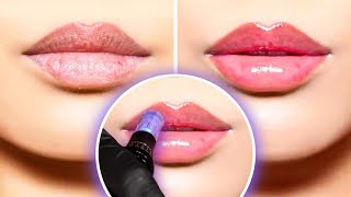 How to get SOFTER and PLUMPER LIPS  Microneedling Facial [upl. by Ennagroeg915]