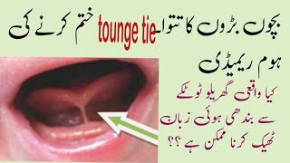 tongue tie kya hota he  tongue tie kya hota he tongue tie kaise Hota he [upl. by Orvie]