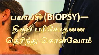 பயாப்சி BIOPSYதிசுப் பரிசோதனை தெரிந்து கொள்வோம்  English Subtitlecancer [upl. by Conway920]