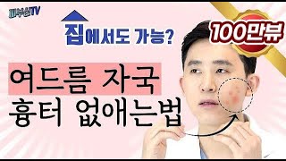 피부과 전문의가 알려주는 여드름자국 흉터 없애는 법 피부과전문의 피부심 [upl. by Airun190]