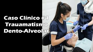 Traumatismo DentoAlveolar  Caso Clínico de Odontologia 1 [upl. by Ongineb]