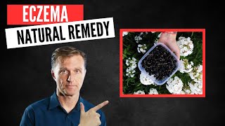 Best Natural Remedy for Eczema [upl. by Winebaum]