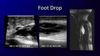 Peripheral Nerve Sonography [upl. by Rechaba341]