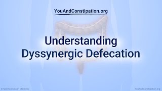 Understanding Dyssynergic Defecation [upl. by Michaud]