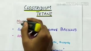 clostridium tetani  microbiology  handwritten notes [upl. by Katlaps]