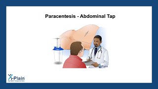 Paracentesis  Abdominal Tap [upl. by Nosreh]