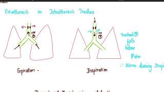 Approach to stridorclinical [upl. by Novyak391]