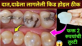 घरातील फक्त 2 वस्तू वापरा दातांन संबंधित सर्व समस्या दूर होतील😱 kitchen tips  home remedies  teeth [upl. by Eelik]