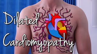 Dilated Cardiomyopathy [upl. by Benjamen]