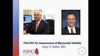 FDG PET for Assessment Myocardial Viability [upl. by Bigford]