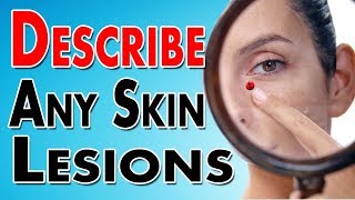 Describing Skin Lesions [upl. by Aznarepse]