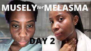 Musely Spot Cream for Melasma Day 2 [upl. by Ained]