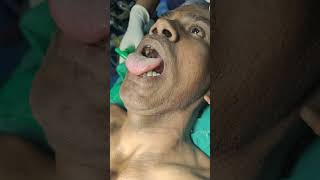 clinical demonstration of thyroglossal cyst [upl. by Gipsy]