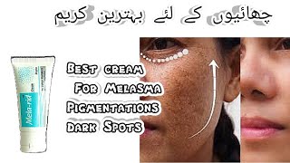 Best cream to treat Melasma dark spots and pigmentationns  Mela rid cream [upl. by Masry]