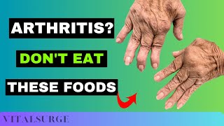 9 Foods To Avoid for Arthritis Stop Now [upl. by Linnette]