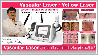 Vascular Laser  Yellow Laser  1st in Western India  Dr Jagdish Sakhiya Sakhiya Skin Clinic [upl. by Ogirdor345]