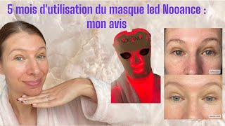 Avis après 5 mois d’utilisation du masque led français Nooance  bon plan et code promo [upl. by Narf]