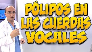 PÓLIPOS EN LAS CUERDAS VOCALES [upl. by Kravits]