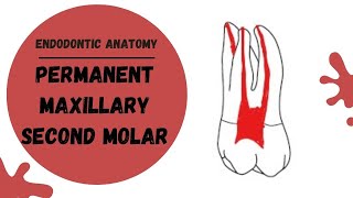 Endodontic Anatomy of the Permanent Maxillary Second Molar  Root canal anatomy [upl. by Meeharb]