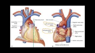 Sagittal CT Chest with Mediastinal Window [upl. by Isbella]