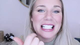 REMOVABLE VENEERS USA REVIEW NYC Emily [upl. by Repip]