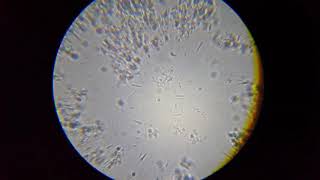 Lactobacillus acidophilus  Лактобацилус ацидофилус Narine [upl. by Charla]