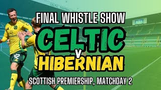 Calmac Leads The Way Against Hibs As Celtic Go Two For Two In The League [upl. by Velda44]