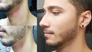 Como ter uma BARBA PERFEITA  3 Truques Rápidos [upl. by Nichole861]