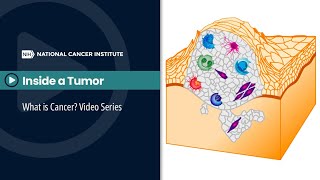 Inside a Tumor What is Cancer Video Series [upl. by Sellma168]