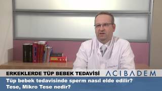 Tüp bebek tedavisinde sperm nasıl elde edilir tese mikro tese nedir [upl. by Stieglitz]