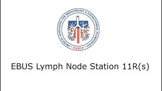 EBUS Lymph Node Station 11Rs [upl. by Cleavland459]