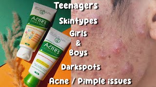 Facewash for acne  Acnes facewash review  pimple solution face wash Acne treatment [upl. by Larrie815]