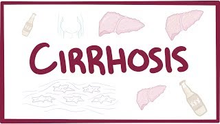 Cirrhosis  causes symptoms diagnosis treatment pathology [upl. by Treblig]