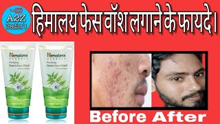 हिमालय फेस वॉश लगाने के फायदे  Himalayas Face Wash Kaise Use Kare  Use Of Himalaya Face Wash [upl. by Mihalco]