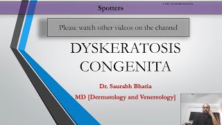 Dyskeratosis Congenita [upl. by Gnus]