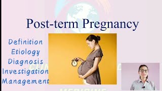 Post term Pregnancy  Definition Etiology Investigation Complications Management [upl. by Sukin417]