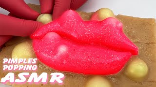 Unwind with a Pimple Popping Livestream on Realistic Silicone Models  Stress Relief Therapy [upl. by Tybie661]