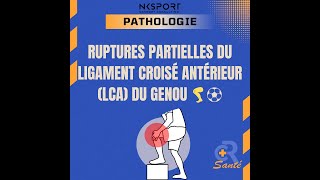 Rupture Partielle du LCA  Comprendre Diagnostiquer et Traiter LCA Kinésithérapie [upl. by Turnheim]