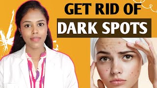 In 3 Days 👍 Remove Acne Scars Dark Spots Pimple Marks Pigmentation 😍 Naturally At Home  In Tamil [upl. by Nylesoj]